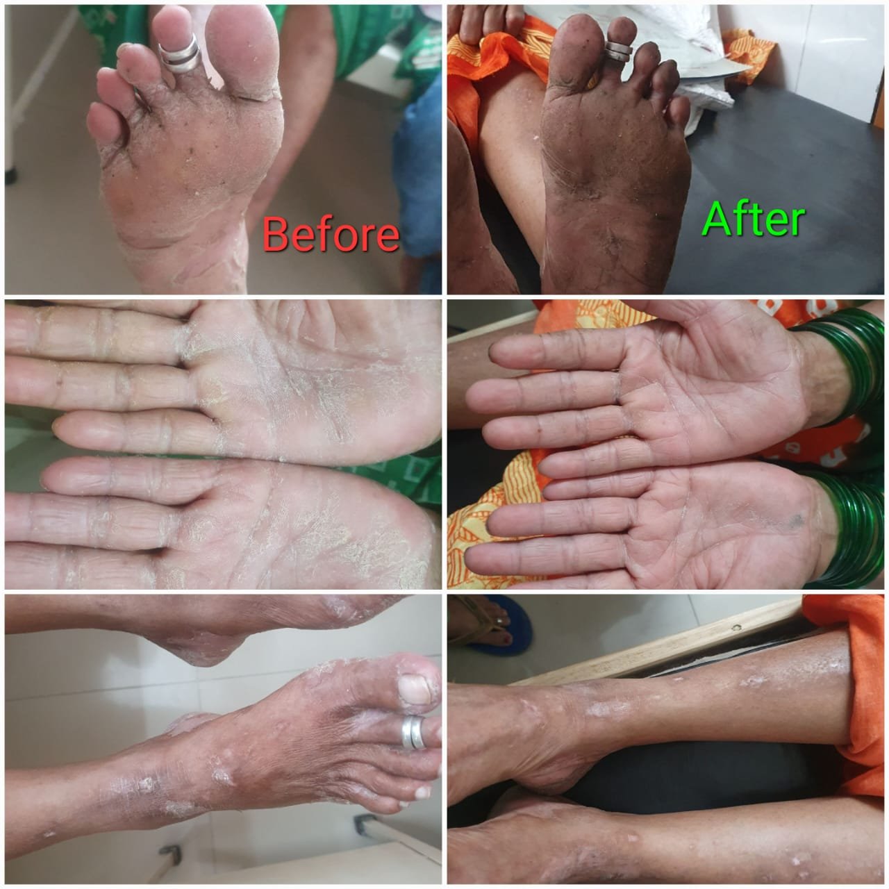 Before and After Skin Treatment
