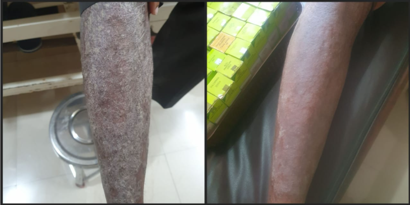 Before and After General Health