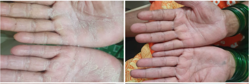 Before and After Child Care